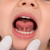 Exame odontológico do frênulo lingual infantil