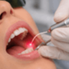 Tratamento odontológico a laser em close-up